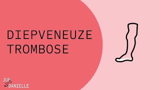 Diepveneuze trombose (trombosebeen)