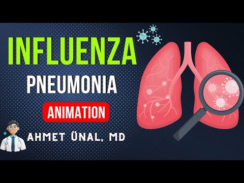 INFLUENZA (flu) VIRUS ANIMATION | PNEUMONIA