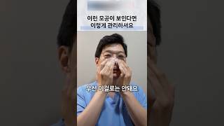 세로로 늘어진 모공, 피지와 탄력을 함께 살피기