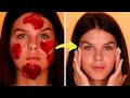 2-INGREDIENT Rose Petal Mask For GLOWING Skin | DIY #shorts