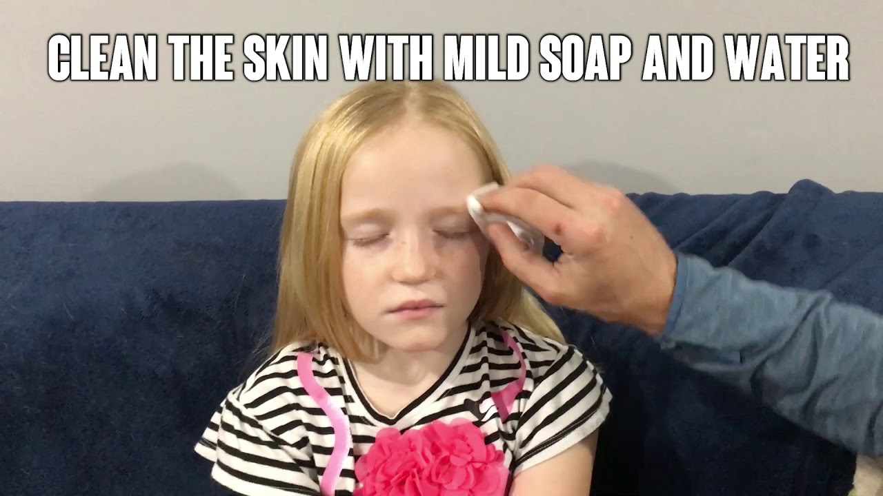 Opthopatch Eye Patches with Fun Girls Design - Medical Eye Patches to treat Amblyopia & Strabismus