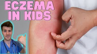 Everything you need to know about Eczema in kids! Causes, symptoms, treatment & home management