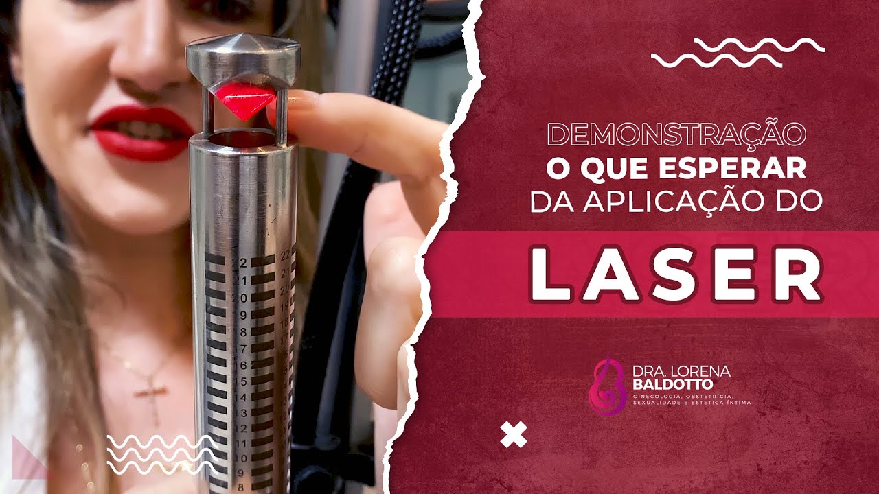 Demonstração o que esperar da aplicação do laser para rejuvenescimento vaginal e perda de urina.