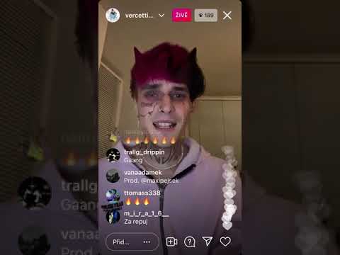 VERCETTI CG - LEAK 👀