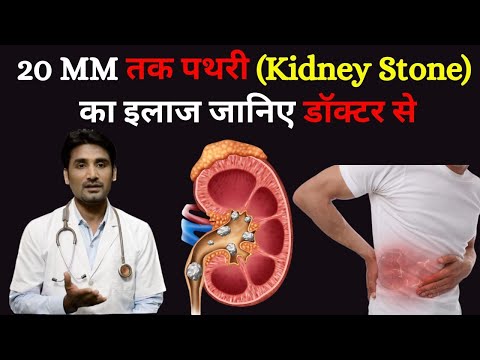 Indian kidney stone remover