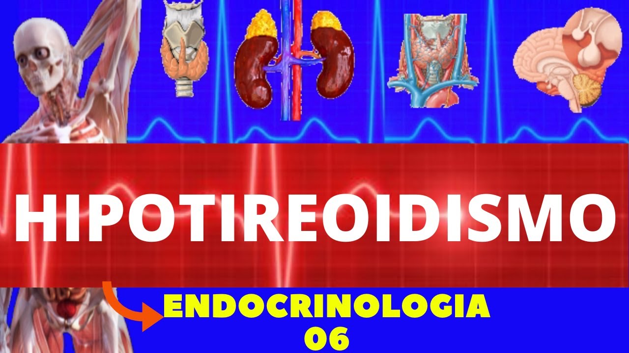 HIPOTIREOIDISMO (CAUSAS, SINTOMAS, DIAGNÓSTICO E TRATAMENTO) - ENDOCRINOLOGIA