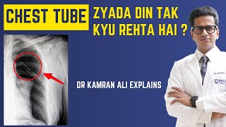 Chest Tube zyada din tak kyun rehta hai? | Prolonged Chest Tube