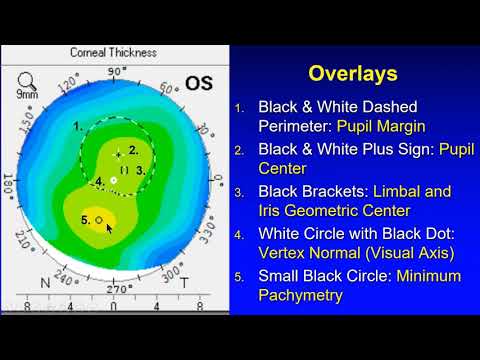 [Online Seminar] Jack Holladay: How to Get the Most out of Pentacam®  and Holladay Report