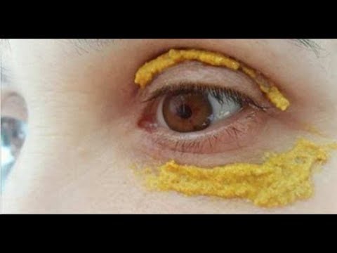 Лимонная кислота для пигментных пятен Миракле глов отбеливающий крем цена отзывы аналоги