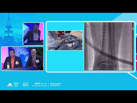 Live Case Presentation #LIVE 3 - D. Christopher Metzger, MD