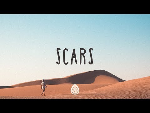 Scars