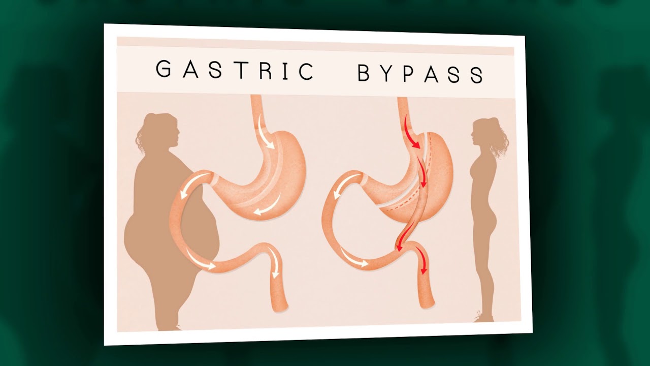 Grzegorz Kowalski-14