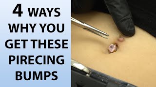 4 Reasons Why You Get Piercing Bumps