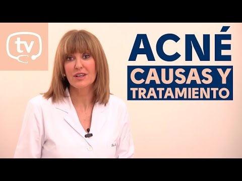Causas y tratamiento del acné