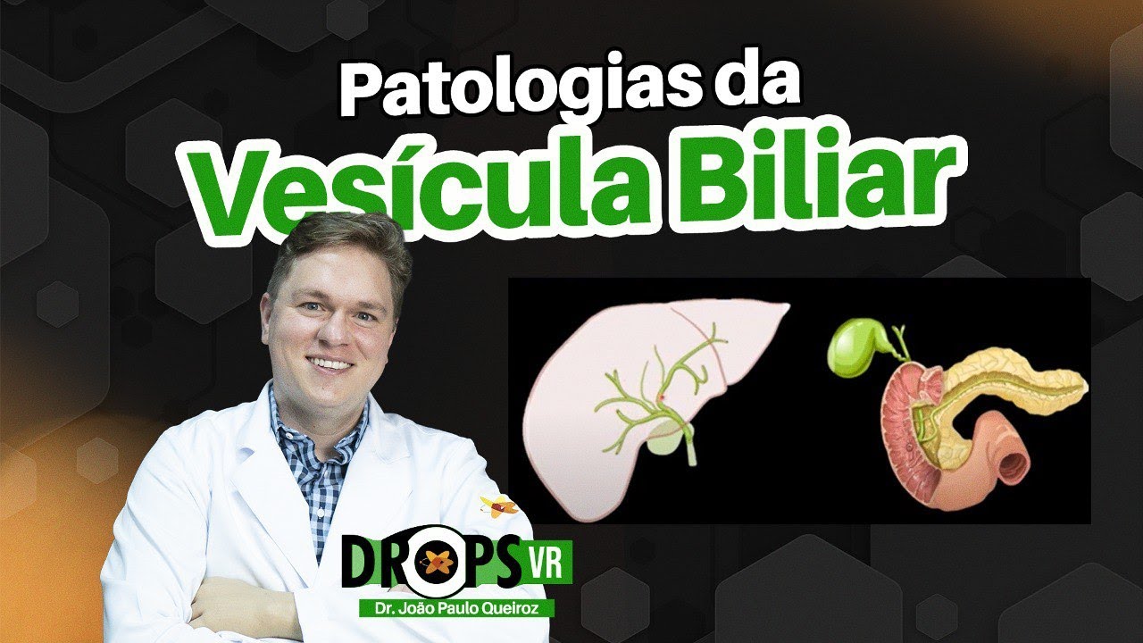 OS EXAMES MAIS IMPORTANTES PARA PATOLOGIAS DA VESÍCULA BILIAR I VOCÊ RADIOLOGISTA