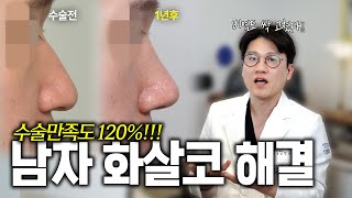 심한 화살코, 비염 해결하기! | 코 수술 후 2주차, 3개월, 1년 경과 비교 화살코성형 케이스  (실리콘 + 비중격 연골), [첫단추 251212]