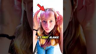 Download lagu What’s Really Growing Under Her Skin mp3 Download lagu What’s Really Growing Under Her Skin mp3