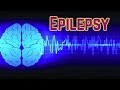 Epilepsy (updated 2023) - CRASH! Medical Review Series