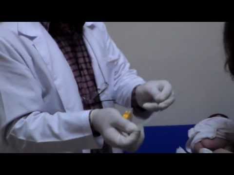 Virus del papiloma humano tratamiento gpc