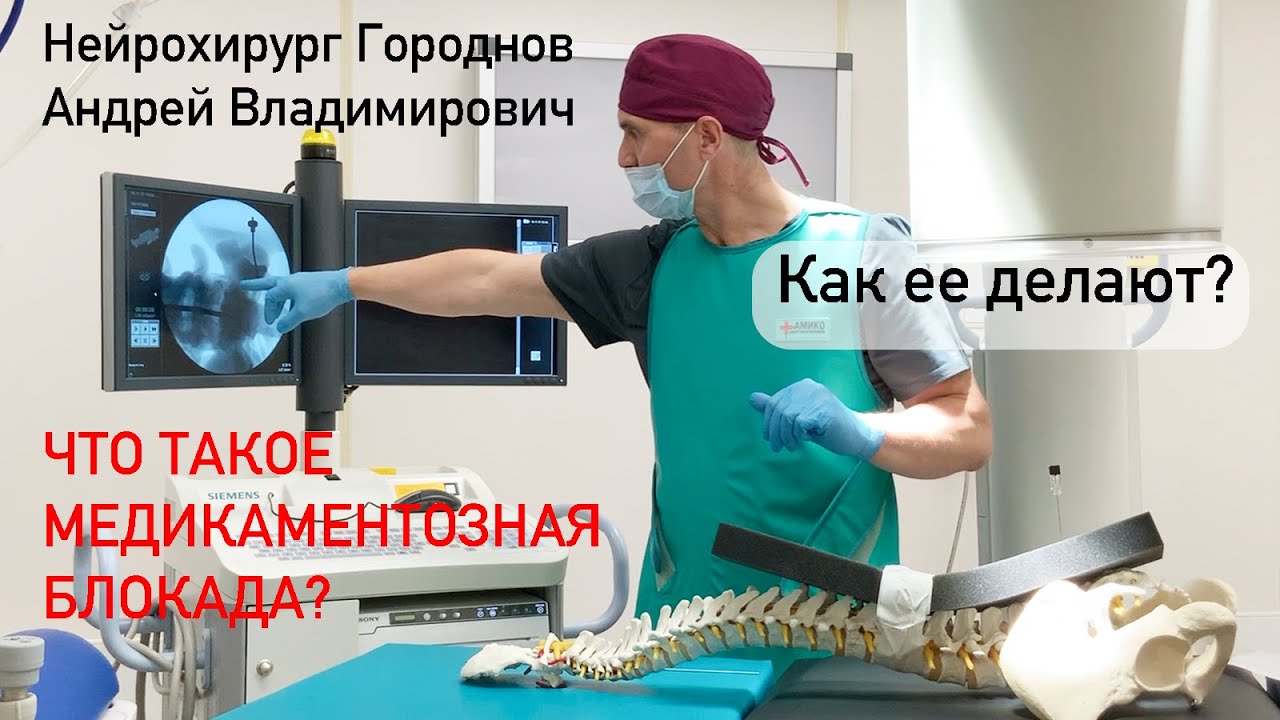 Что такое медикаментозная блокада Как ее делают