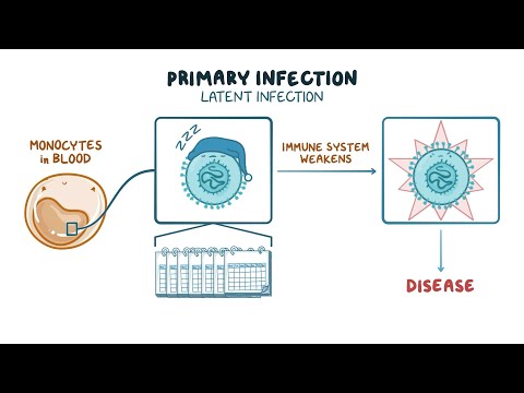 Understanding Cytomegalovirus (CMV) Infection After Transplant