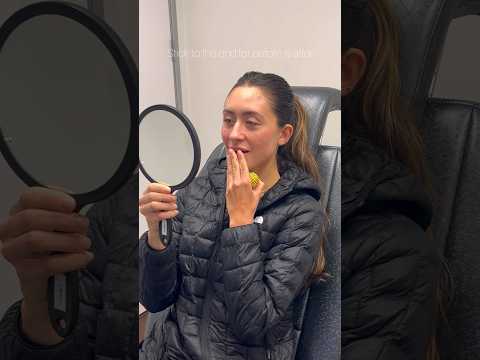 Unlock the secrets of cheek filler 👀 before & afters at end of video #filler #cheeks #injections