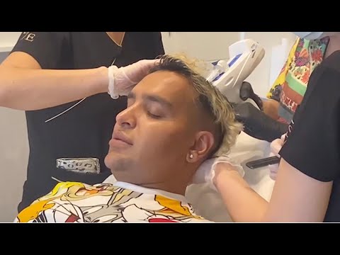 Self Confessed "Filler Addict" Is Losing Hair From Stress