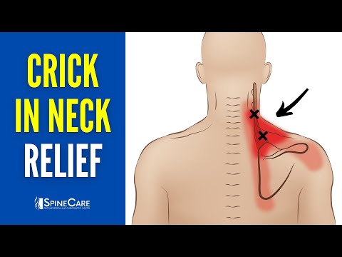 How to Instantly Fix a Crick in Your Neck (PAIN TURNING HEAD)
