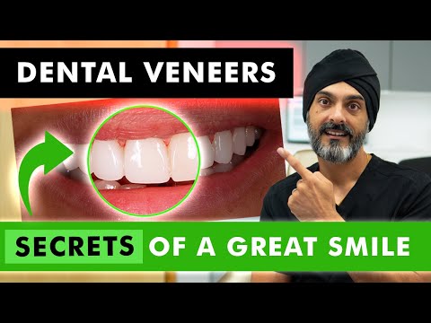 Dental Veneer Options in 2025: Composite vs Porcelain Explained