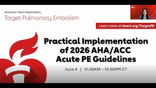SIR-RFS Webinar