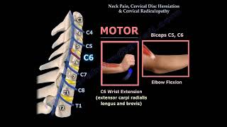 Cervical Disc Herniation and Radiculopathy Symptoms, and Clinical Findings