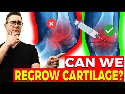 , title : 'Can We Reverse Arthritis & Regrow Cartilage? [New Studies]'