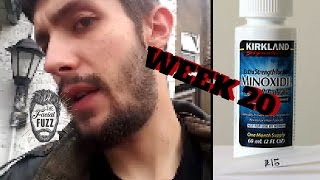 Minoxidil Beard | Week 20 | The Experiment | #FacialFuzzFridays