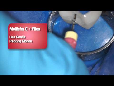Dentsply C Plus Files - Review by Dr. Scott Norton