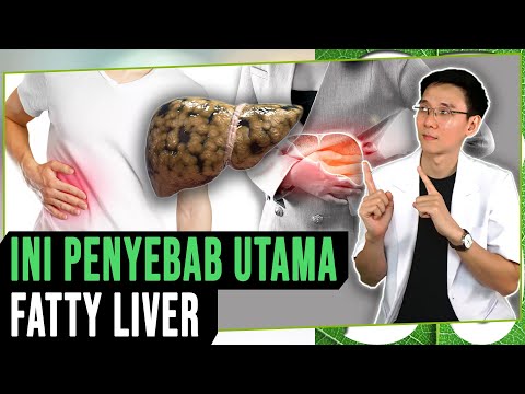 Ini Penyebab & Gejala Perlemakan Hati (Fatty Liver)