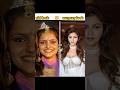TV Serial Actress Ki Old Surgery Look Treanding Viral