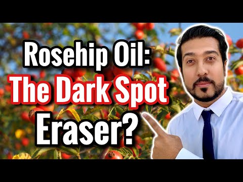Rosehip Oil for Dark Spots in Melasma and Hyperpigmentation