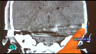 Carabayllo: Bebé impactada por bala perdida se aferra a la vida