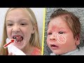 Trinity Loses Her Tooth and Preston's Rare Baby Skin Rash!! Trinity Loses Her Tooth and Preston's Rare Baby Skin Rash!!