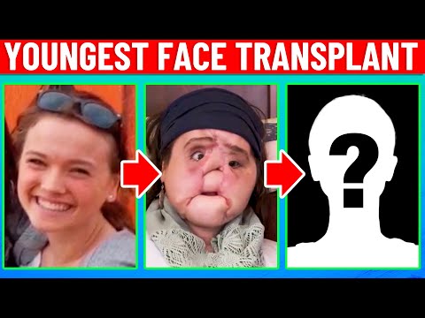 Plastic Surgeon Reacts to The Youngest Face...