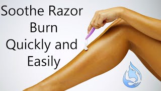 How to Soothe Razor Burn Quickly and Easily