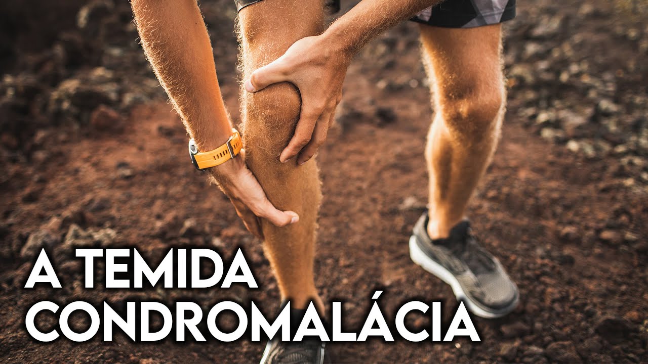 Tenho condromalácia: posso correr?