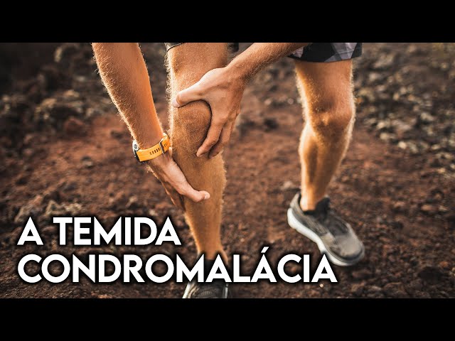 Tenho condromalácia: posso correr?
