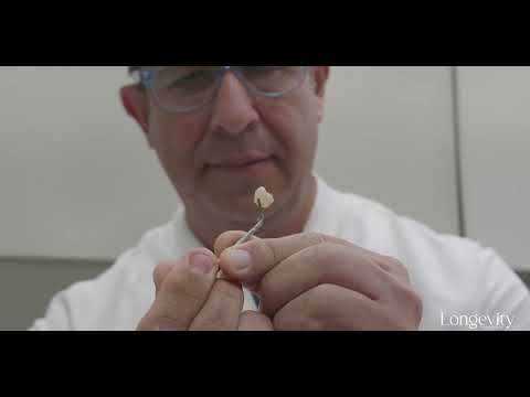 Your Oral Health Impacts Your Brain and Heart: Regenerative Dentistry is the Future!