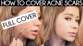 HOW TO COVER ACNE SCARS | how to cover acne with makeup