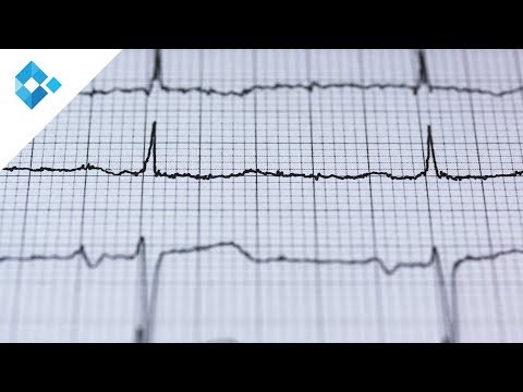 Vorhofflimmern | Assoz. Prof. Dr. Daniel Scherr