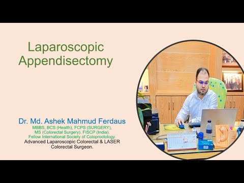Laparoscopic Appendisectomy