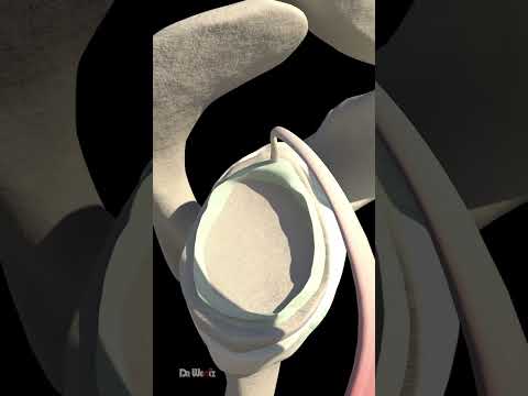What Is a Shoulder SLAP Tear (Animation)