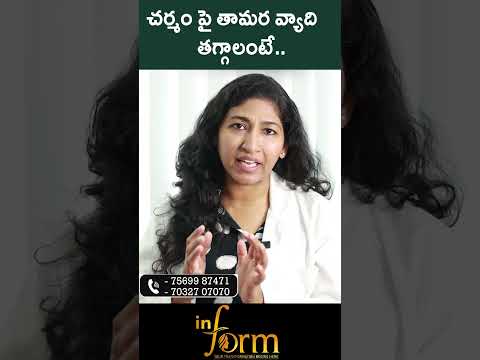 #shorts | Permanent Solution For Tamara Skin Diseases || Inform Skin Clinic |