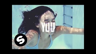 Vicetone - Collide ft. Rosi Golan (Official Lyric Video)